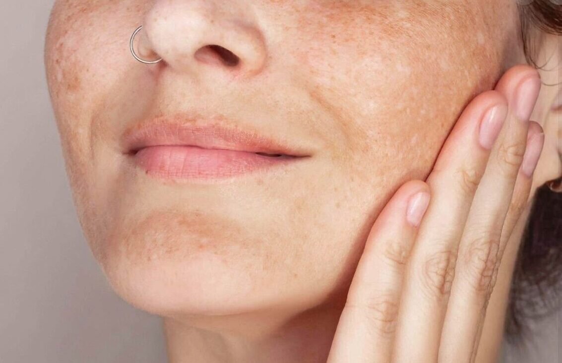 SKIN IMAGE